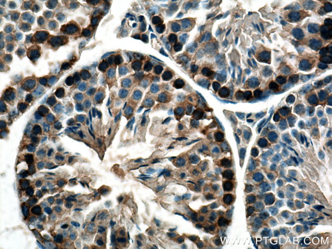 UBA6 Antibody in Immunohistochemistry (Paraffin) (IHC (P))