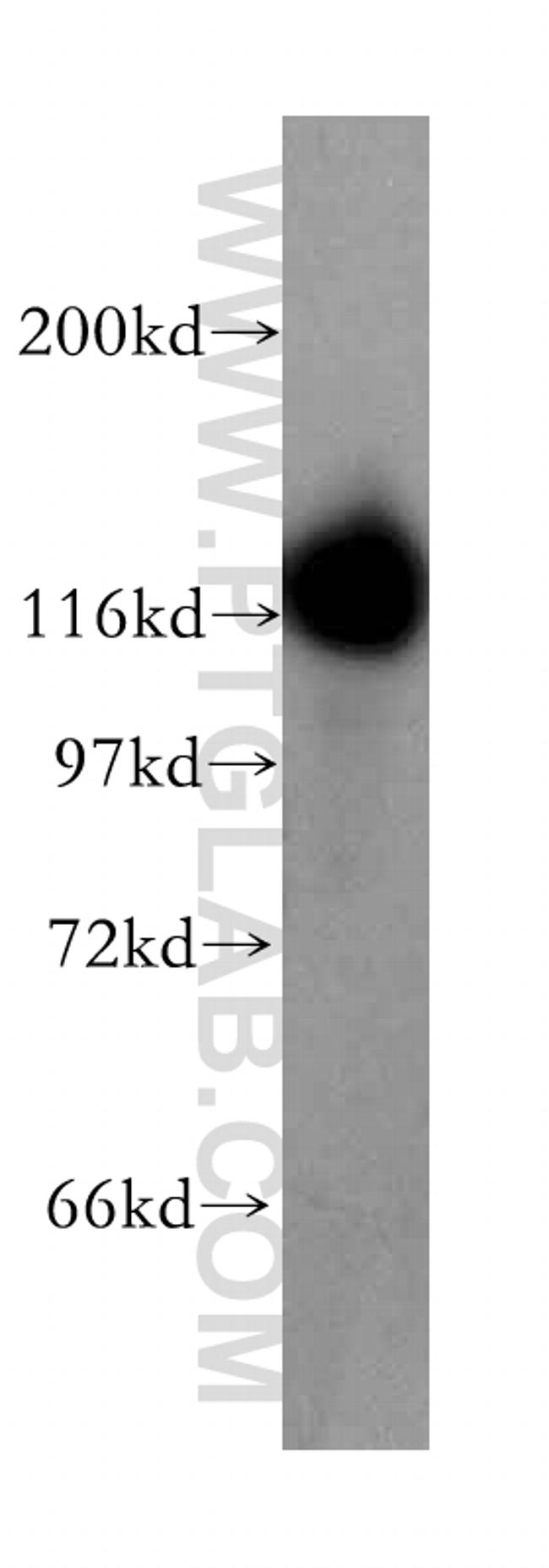 UBA6 Antibody in Western Blot (WB)