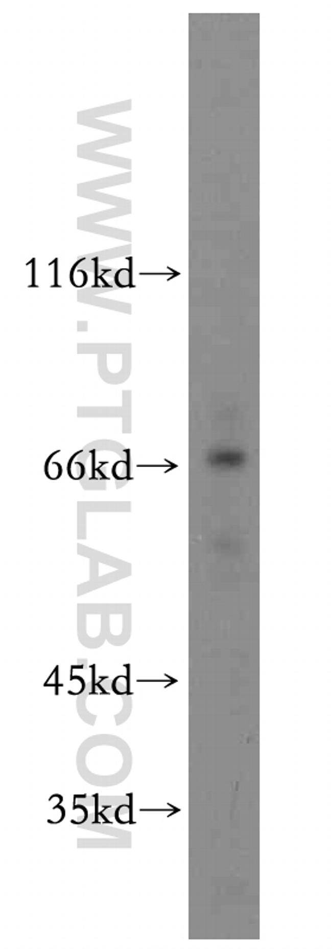 SOX5 Antibody in Western Blot (WB)