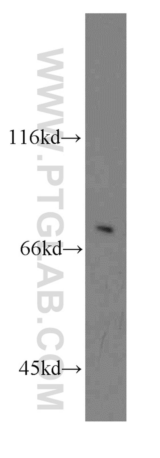 SOX5 Antibody in Western Blot (WB)