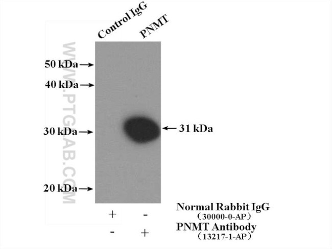 PNMT Antibody in Immunoprecipitation (IP)