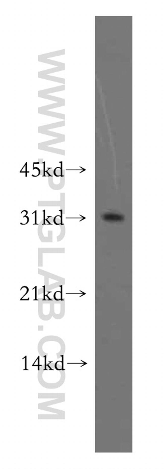 PNMT Antibody in Western Blot (WB)