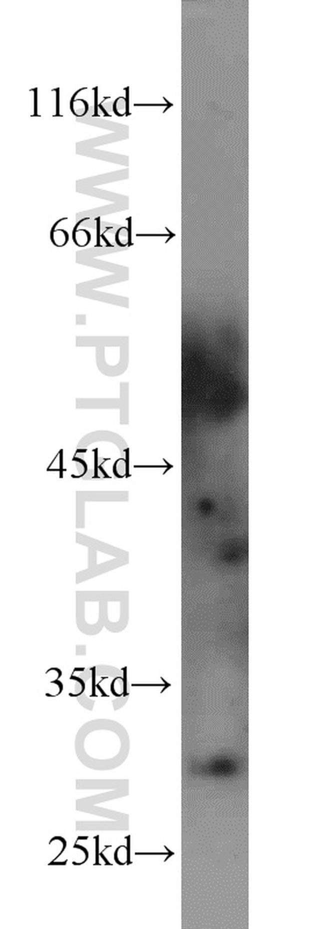 PNMT Antibody in Western Blot (WB)