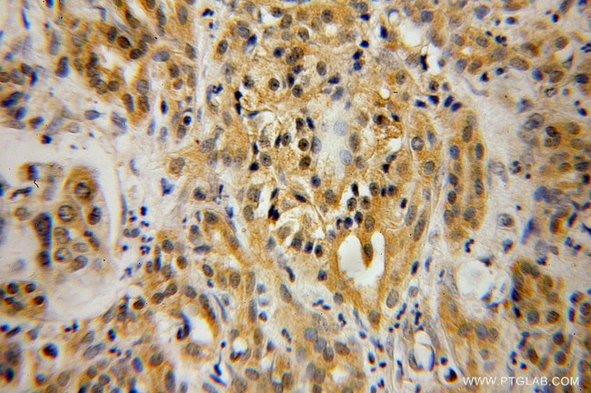 PIP4K2B Antibody in Immunohistochemistry (Paraffin) (IHC (P))