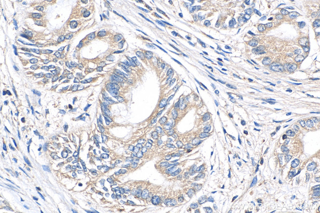 PIP4K2B Antibody in Immunohistochemistry (Paraffin) (IHC (P))