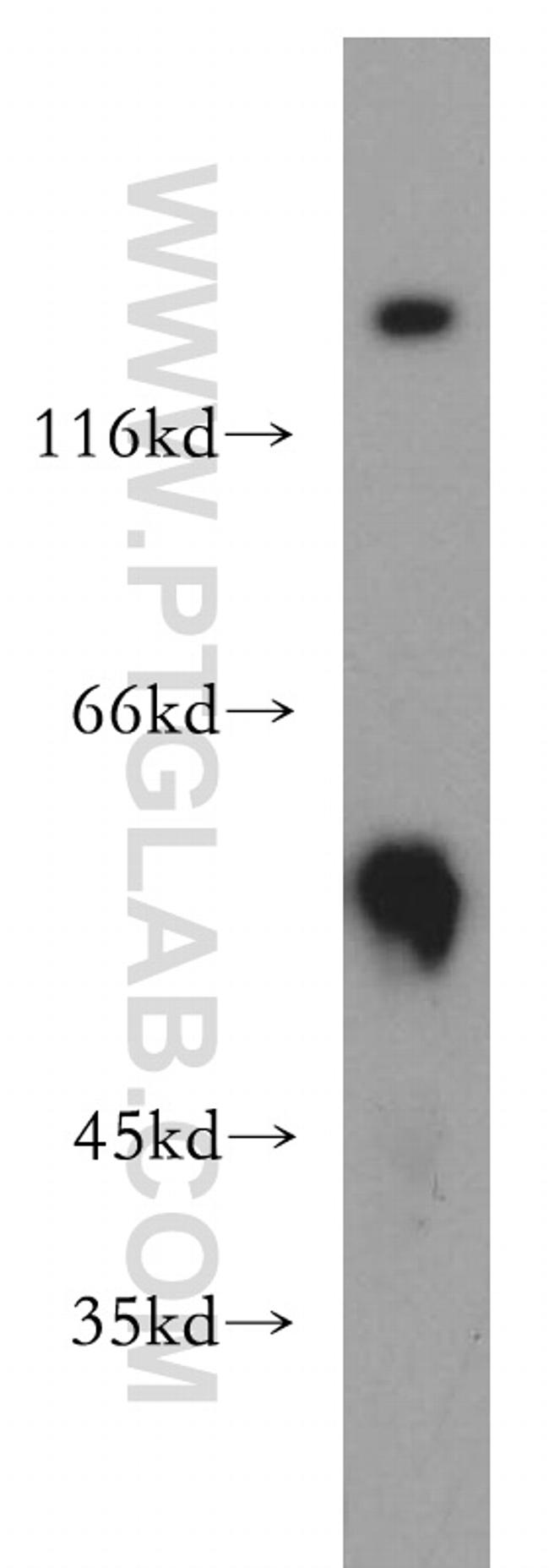 PIP4K2B Antibody in Western Blot (WB)