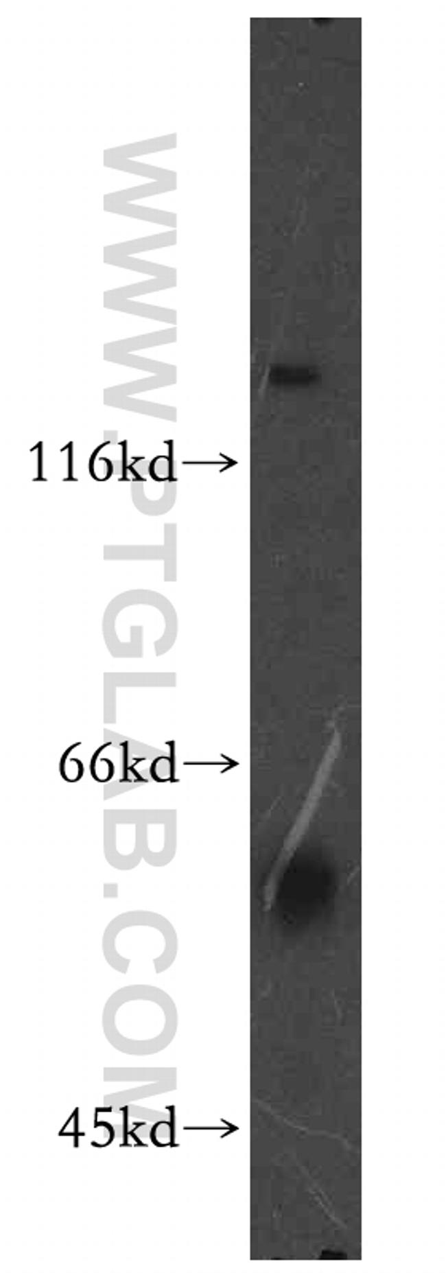 PIP4K2B Antibody in Western Blot (WB)