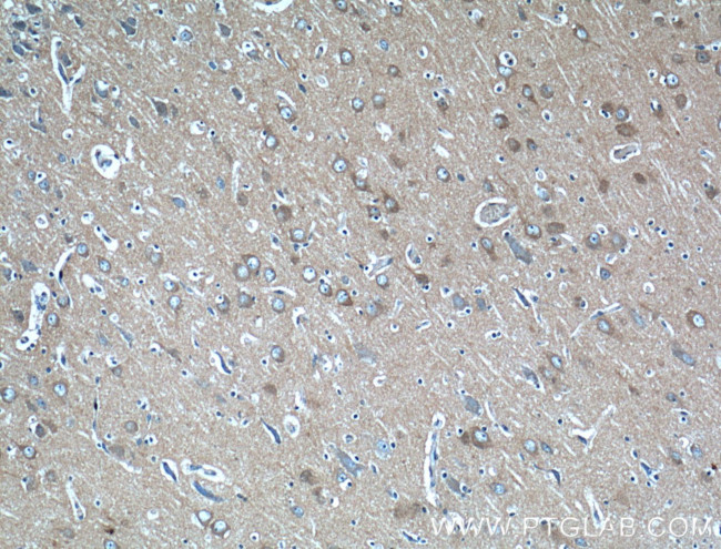 PACSIN1 Antibody in Immunohistochemistry (Paraffin) (IHC (P))