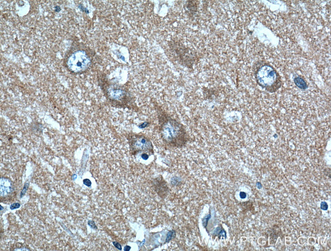 PACSIN1 Antibody in Immunohistochemistry (Paraffin) (IHC (P))