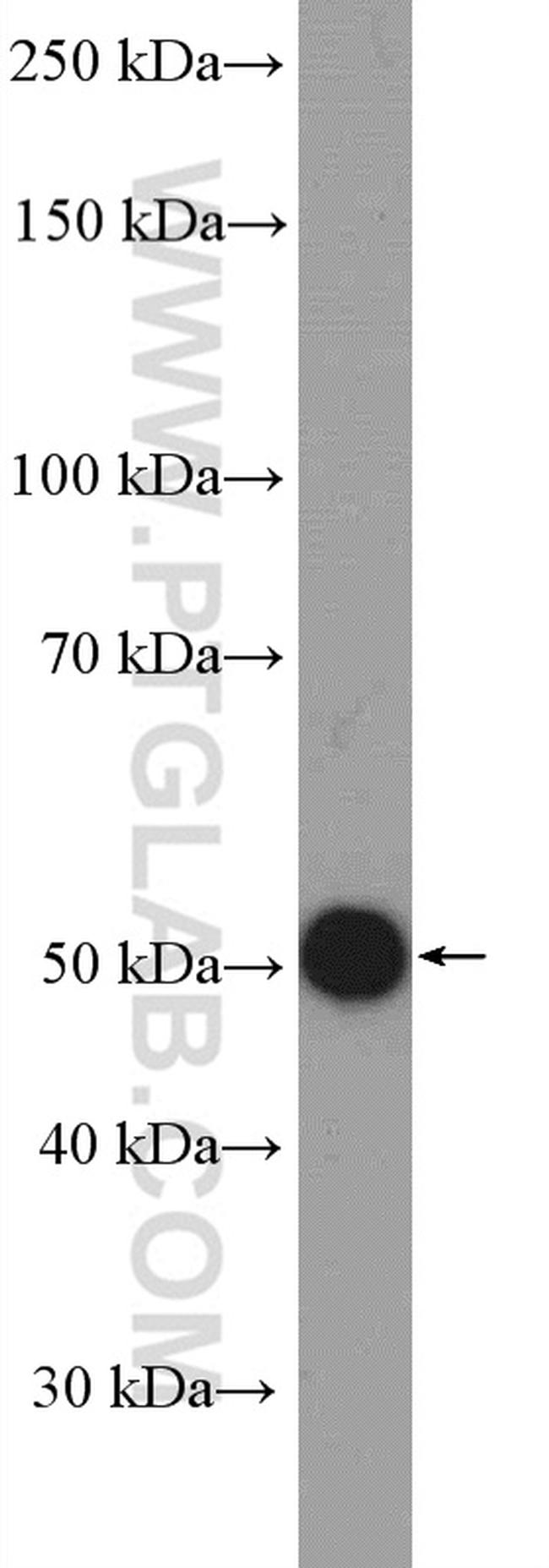 PACSIN1 Antibody in Western Blot (WB)