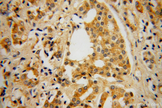 GBP5 Antibody in Immunohistochemistry (Paraffin) (IHC (P))