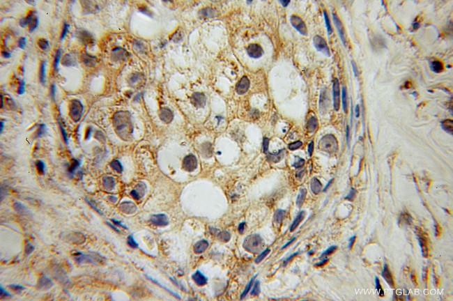 RAMP2 Antibody in Immunohistochemistry (Paraffin) (IHC (P))