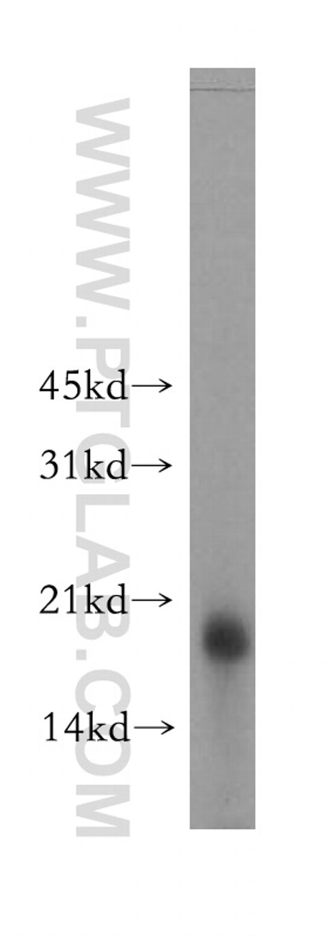 RAMP2 Antibody in Western Blot (WB)