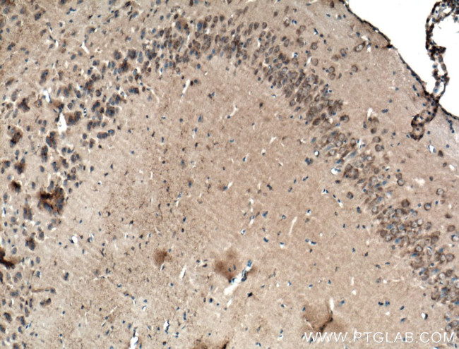 LRG1 Antibody in Immunohistochemistry (Paraffin) (IHC (P))