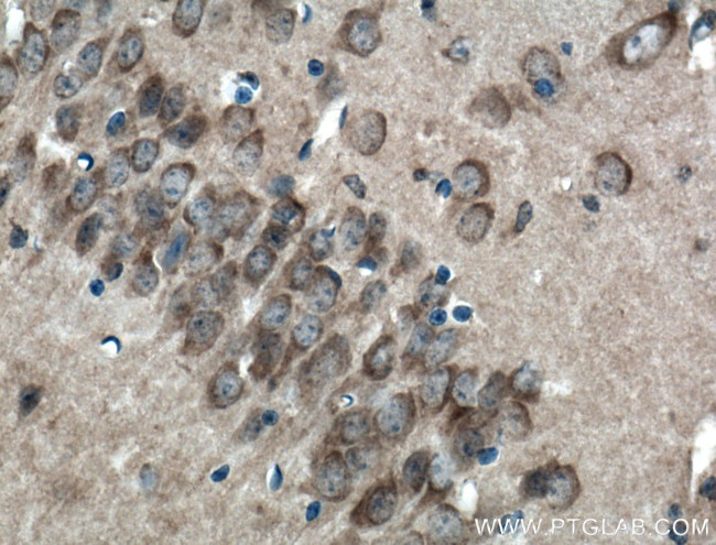 LRG1 Antibody in Immunohistochemistry (Paraffin) (IHC (P))