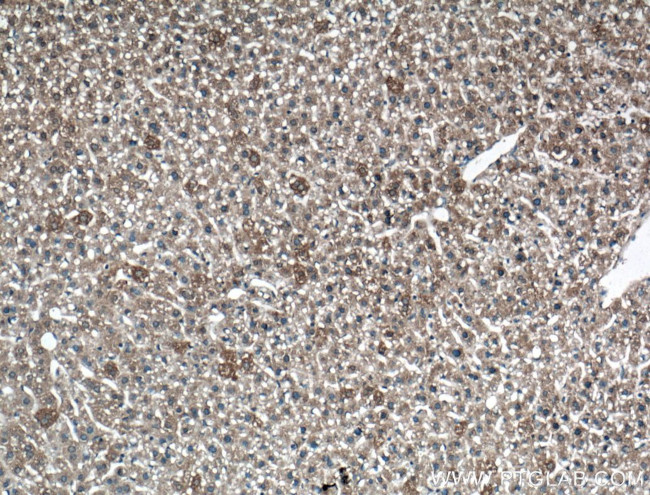 LRG1 Antibody in Immunohistochemistry (Paraffin) (IHC (P))