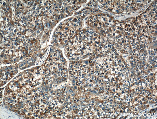 LRG1 Antibody in Immunohistochemistry (Paraffin) (IHC (P))