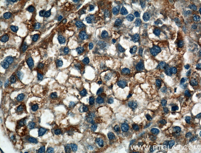 LRG1 Antibody in Immunohistochemistry (Paraffin) (IHC (P))