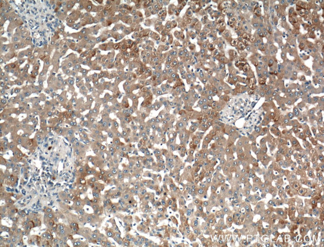 LRG1 Antibody in Immunohistochemistry (Paraffin) (IHC (P))