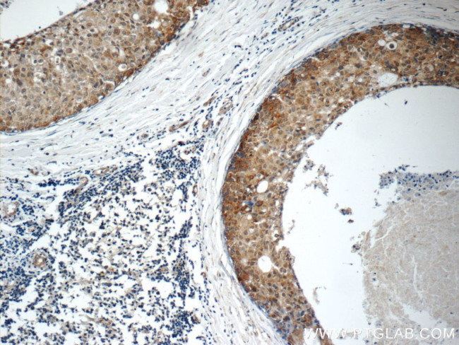 ARSB Antibody in Immunohistochemistry (Paraffin) (IHC (P))