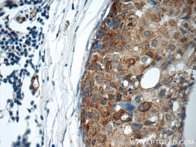 ARSB Antibody in Immunohistochemistry (Paraffin) (IHC (P))