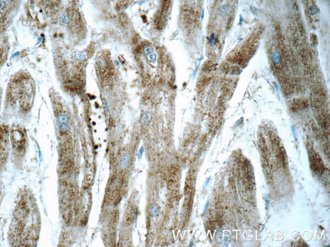 ARSB Antibody in Immunohistochemistry (Paraffin) (IHC (P))