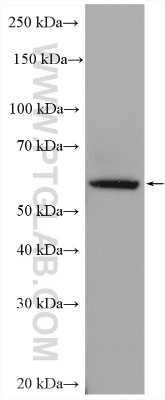 ARSB Antibody in Western Blot (WB)