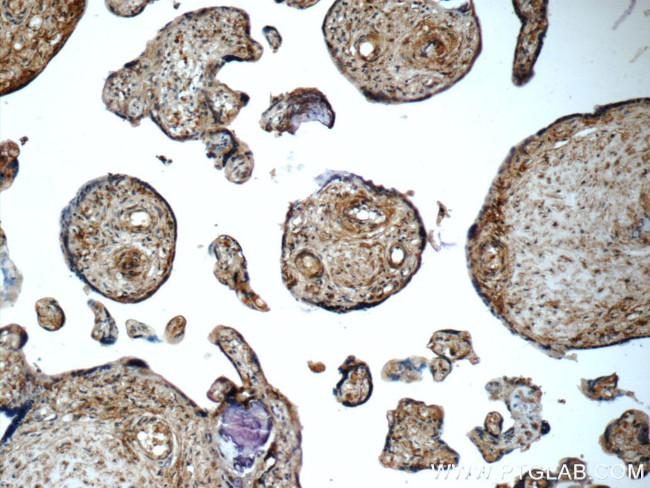 ARSB Antibody in Immunohistochemistry (Paraffin) (IHC (P))