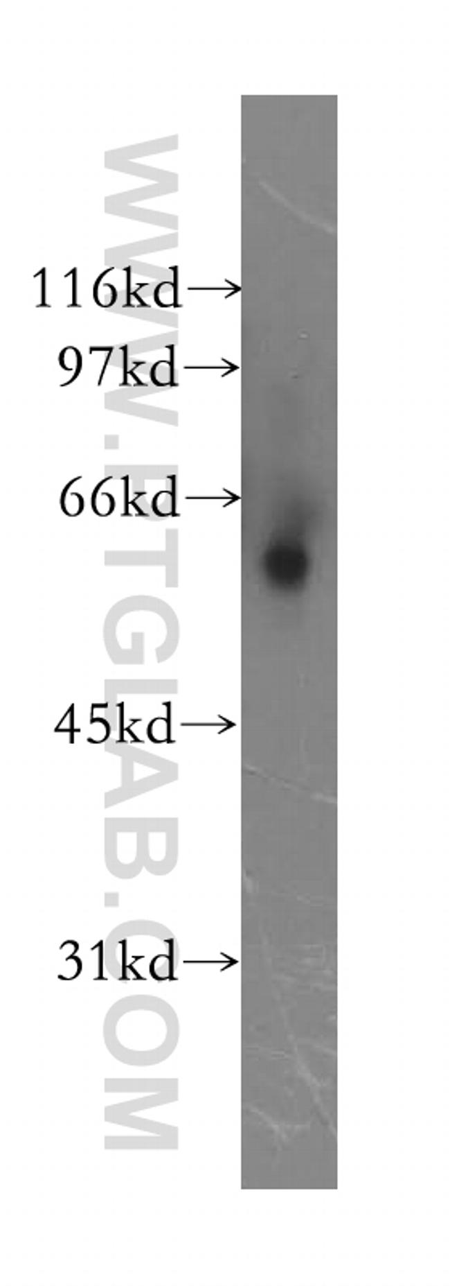 Alpha-2-antiplasmin Antibody in Western Blot (WB)