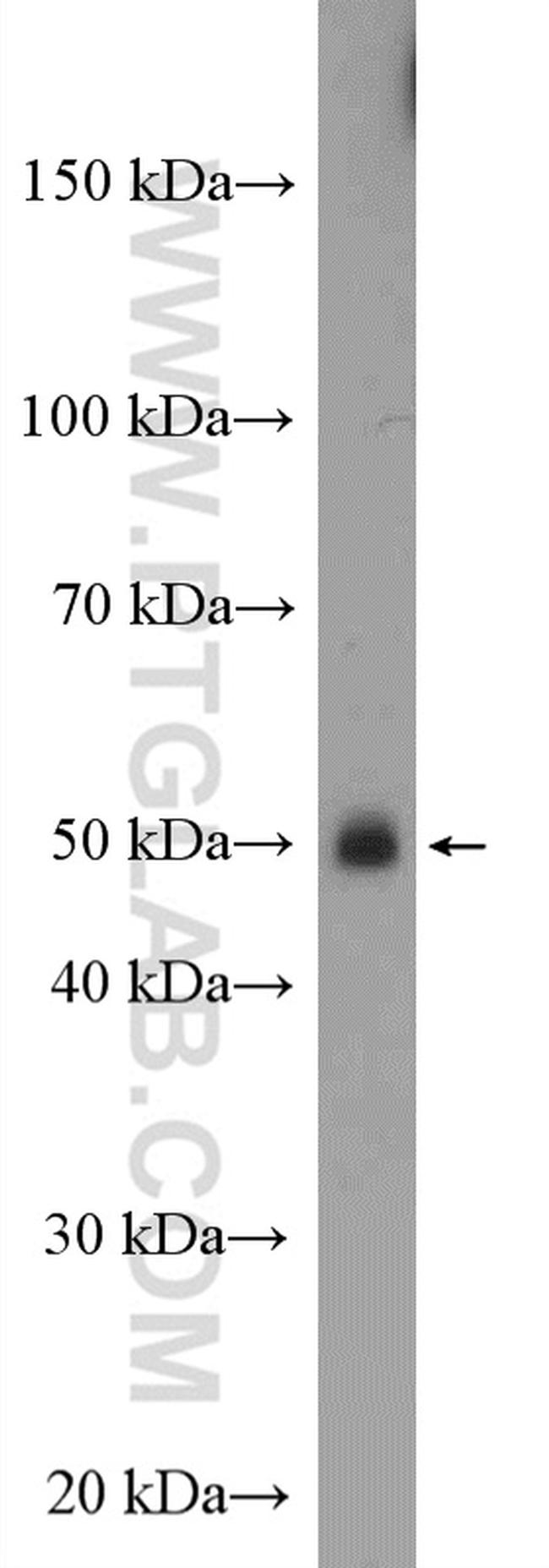 Alpha-2-antiplasmin Antibody in Western Blot (WB)