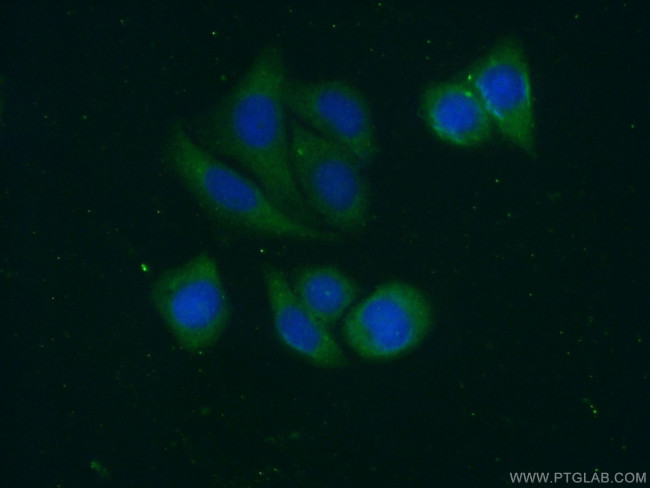 Alpha-2-antiplasmin Antibody in Immunocytochemistry (ICC/IF)