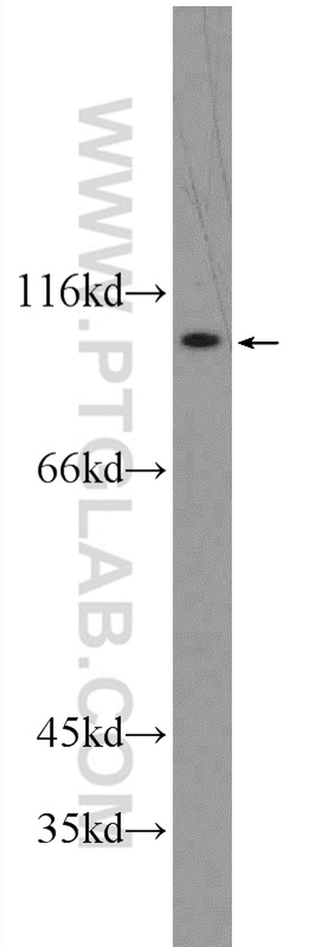 ATP12A Antibody in Western Blot (WB)