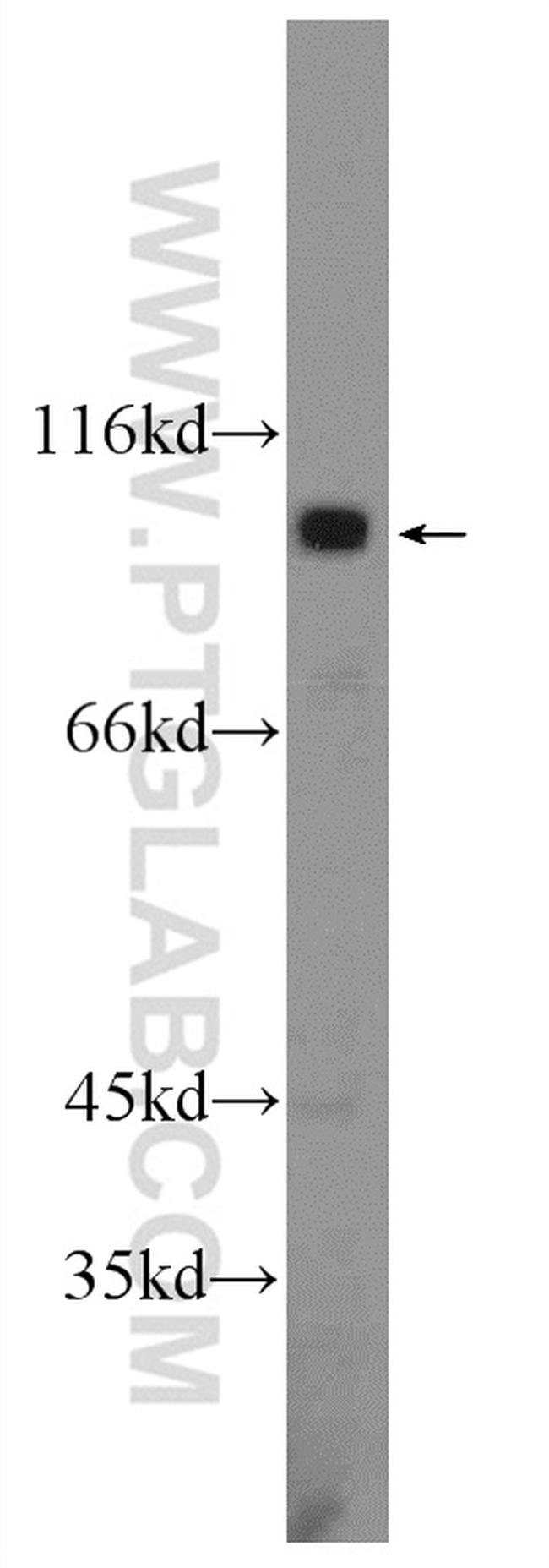 ATP12A Antibody in Western Blot (WB)