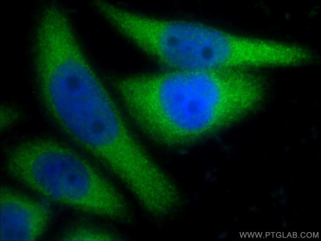 CYP1A1 Antibody in Immunocytochemistry (ICC/IF)