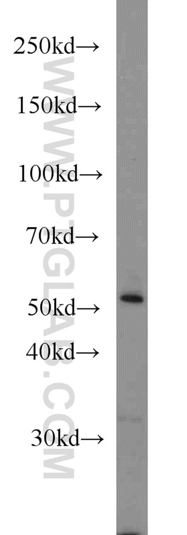 CYP1A1 Antibody in Western Blot (WB)