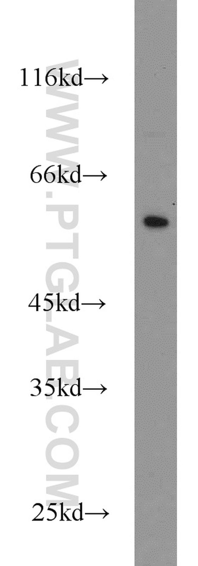 CYP4F12 Antibody in Western Blot (WB)