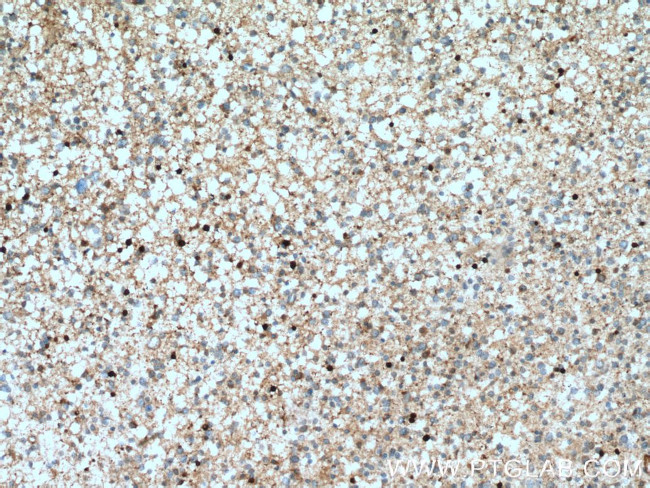 ASPA Antibody in Immunohistochemistry (Paraffin) (IHC (P))