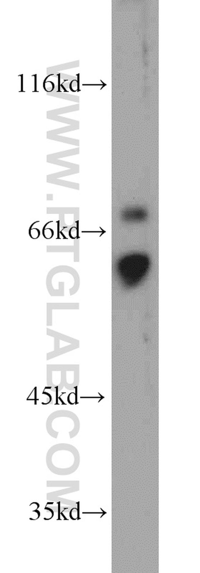 CD89 Antibody in Western Blot (WB)