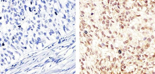 c-Myc Antibody in Immunohistochemistry (Paraffin) (IHC (P))