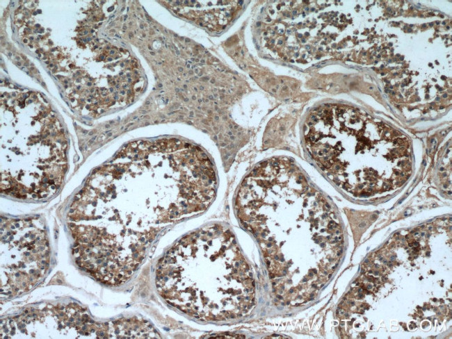 SRGAP1 Antibody in Immunohistochemistry (Paraffin) (IHC (P))