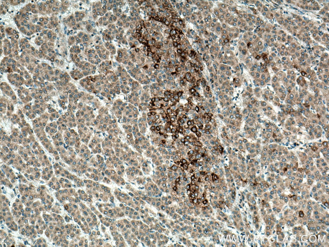 SRGAP1 Antibody in Immunohistochemistry (Paraffin) (IHC (P))