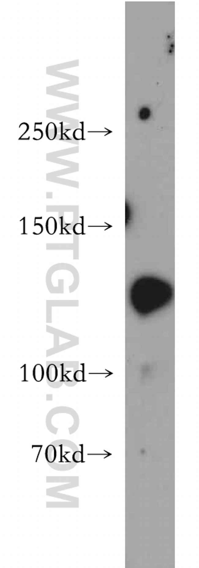 SRGAP1 Antibody in Western Blot (WB)
