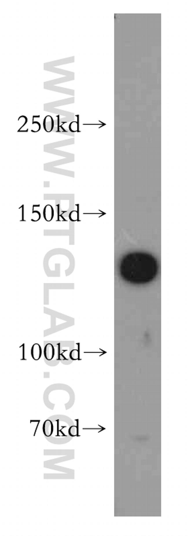 SRGAP1 Antibody in Western Blot (WB)