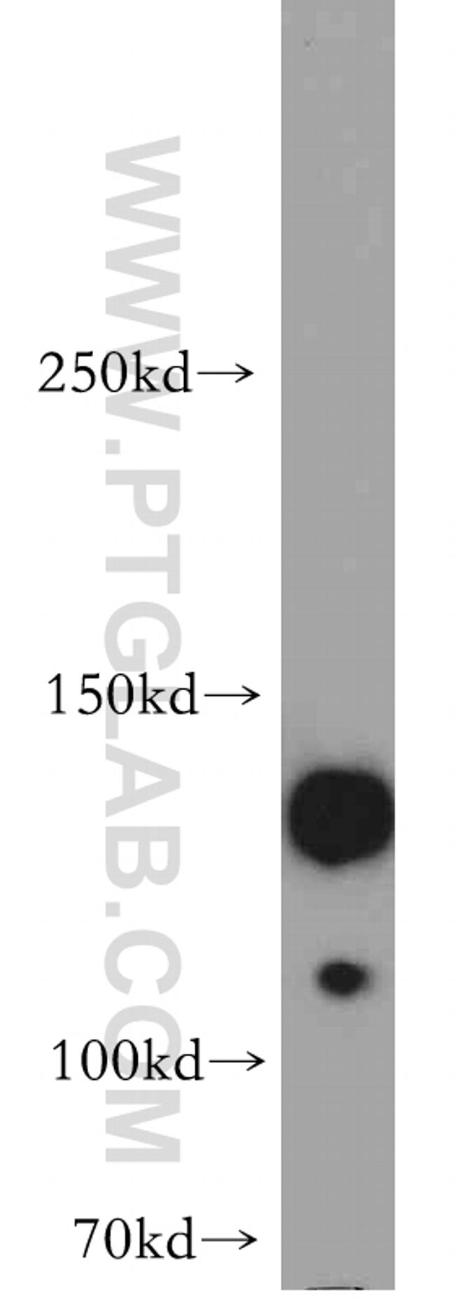 SRGAP1 Antibody in Western Blot (WB)