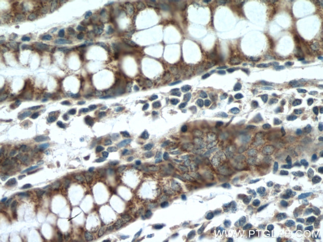 BMP5 Antibody in Immunohistochemistry (Paraffin) (IHC (P))