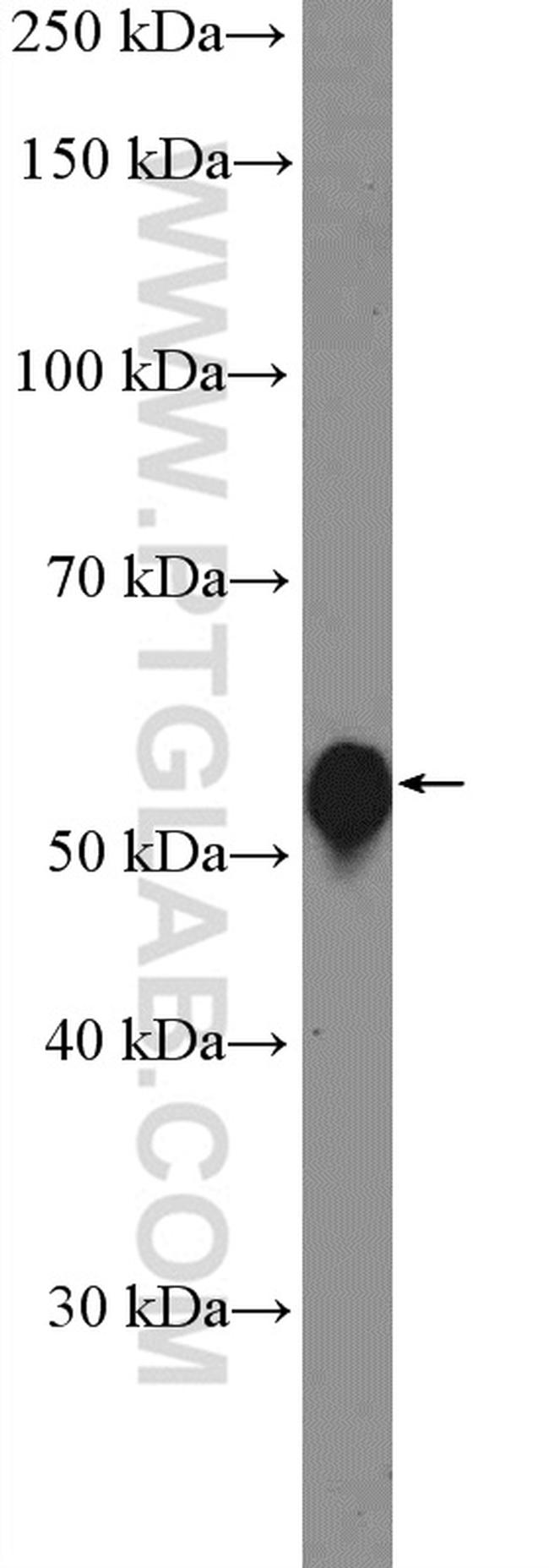 BMP5 Antibody in Western Blot (WB)