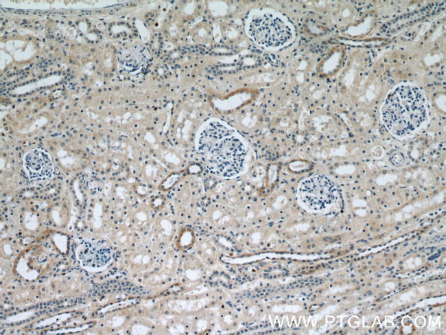 SPPL2A Antibody in Immunohistochemistry (Paraffin) (IHC (P))