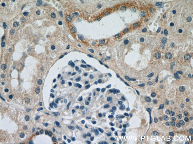 SPPL2A Antibody in Immunohistochemistry (Paraffin) (IHC (P))