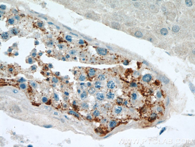 SPPL2A Antibody in Immunohistochemistry (Paraffin) (IHC (P))