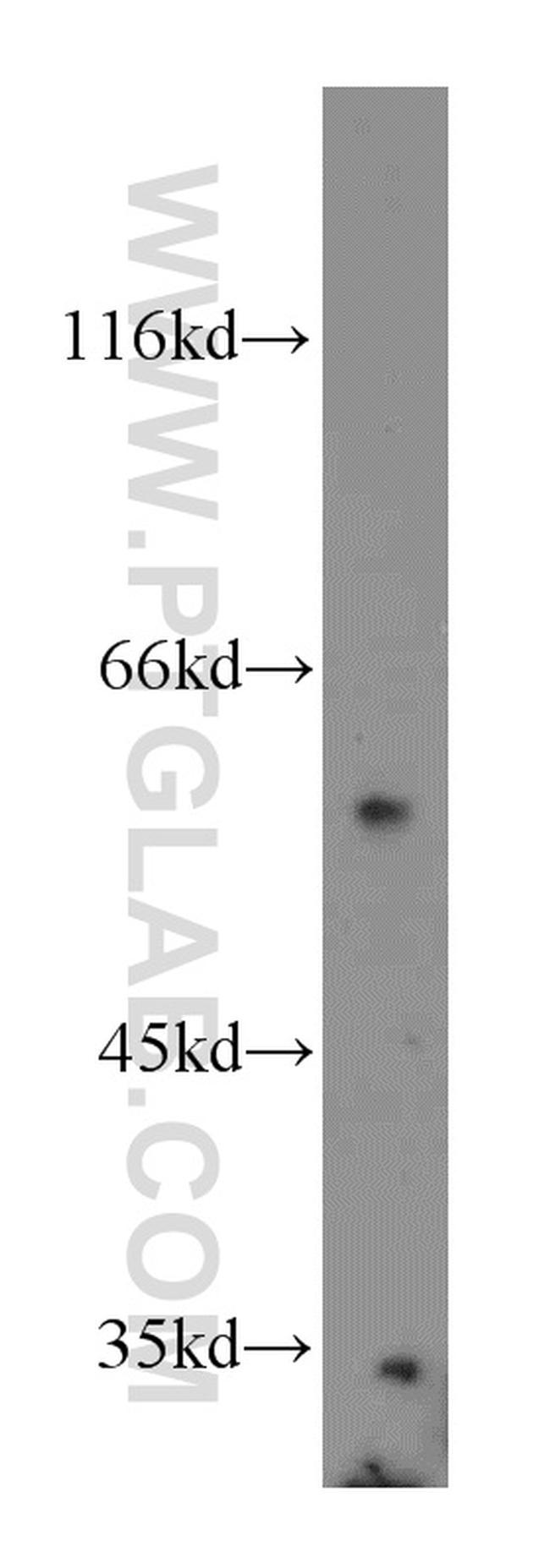 SPPL2A Antibody in Western Blot (WB)